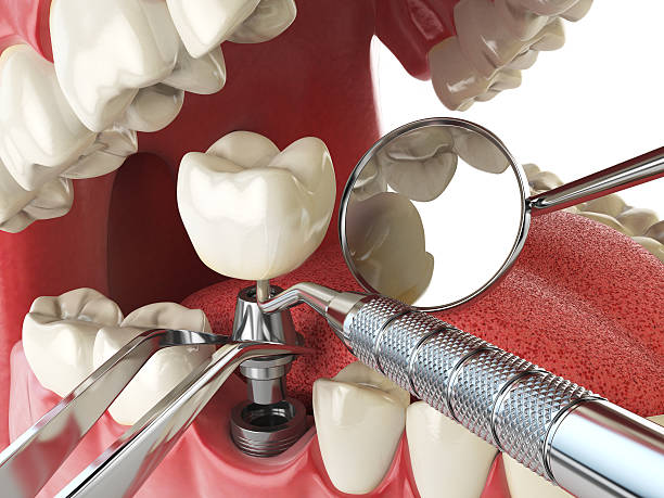 Best Root Canal Emergency Dentist  in Jamul, CA